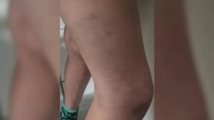 Chicote e queimaduras polícia descobre “rotina de tortura” de crianças em SC
