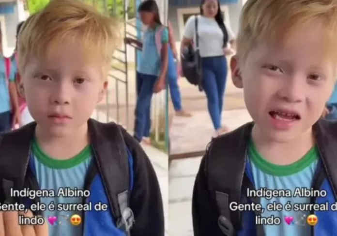 criança indígena com albinismo