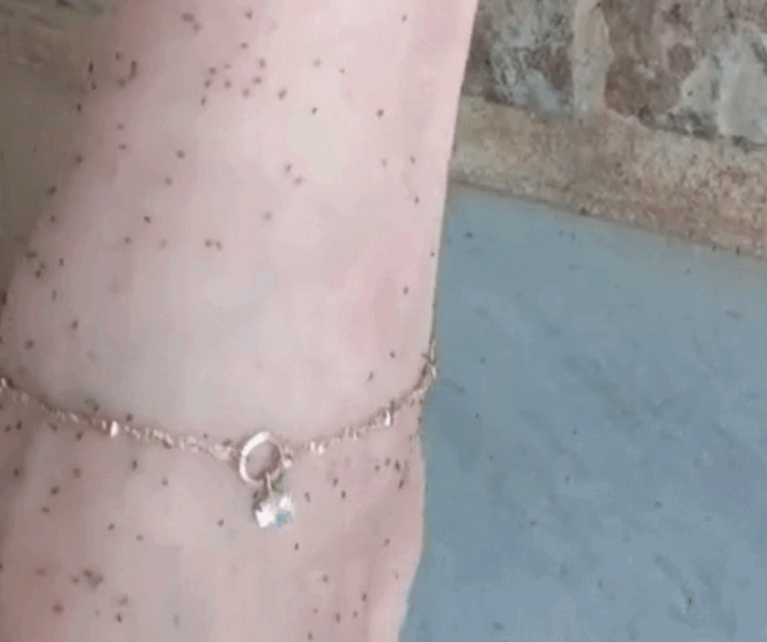 Infestação de mosquito faz moradores em SC usarem luvas no calor e virarem 'prisioneiros nas próprias casas'