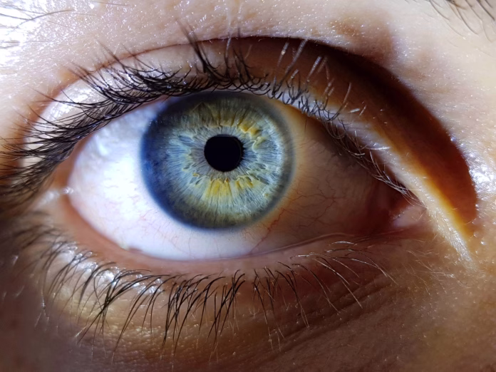 Pessoa sendo examinada para detectar anemia pelos olhos com apoio de inteligência artificial