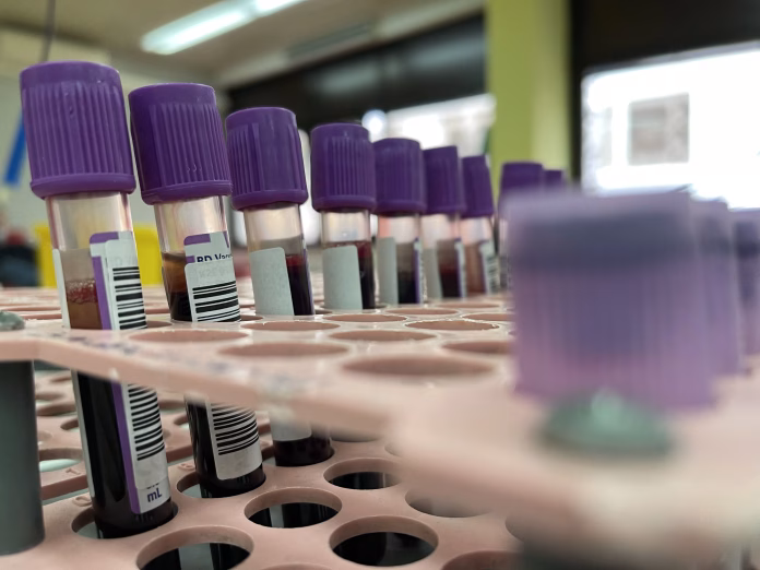 Frascos de coleta em laboratório ligados ao estudo sobre jejum para exames de sangue