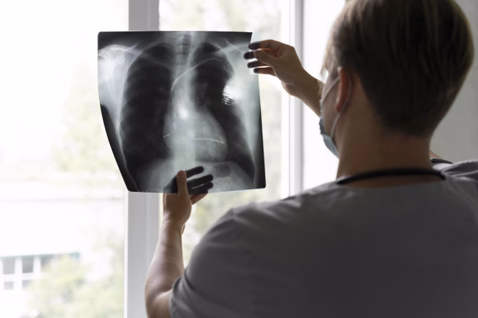 Médico analisa exame ligado ao teste genômico no câncer de pulmão